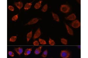 Immunofluorescence analysis of L929 cells using HPS4 Polyclonal Antibody at dilution of 1:100. (HPS4 抗体)