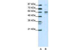 Western Blotting (WB) image for anti-General Transcription Factor IIF, Polypeptide 1, 74kDa (GTF2F1) antibody (ABIN2463819) (GTF2F1 抗体)