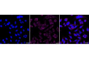 Immunocytochemical staining of HepG2 cells with Melanocortin 5 receptor antibody (ABIN7799355), 1:1,000). (Recombinant MC5 Receptor 抗体)