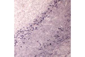IHC on rat brain using Rabbit antibody to Vesicle-trafficking protein SEC22b (SEC22B, SEC22L1,  ERS24): IgG (ABIN351370) at a concentration of 30 µg/ml.