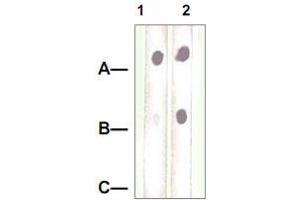 Dot Blot : 1 ug peptide was blot onto NC membrane. (Neuropilin 1 抗体)
