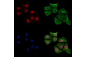Phospho-ERK1/2 (Thr177/Thr160) Antibody staining Hela cells(heat shock treatment) by IF/ICC. (ERK1/2 抗体  (pThr160, pThr177))