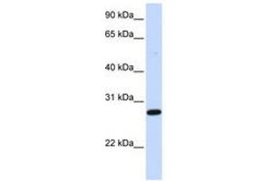 Image no. 1 for anti-Deoxycytidine Kinase (DCK) (AA 180-229) antibody (ABIN6741110) (DCK 抗体  (AA 180-229))