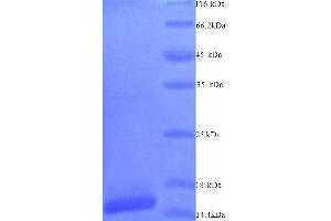 SDS-PAGE (SDS) image for SIVA1, Apoptosis-Inducing Factor (SIVA1) (AA 1-110), (Isoform 2) protein (His tag) (ABIN5713834)