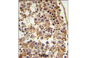 FANCC Antibody IHC analysis in formalin fixed and paraffin embedded testis tissue followed by peroxidase conjugation of the secondary antibody and DAB staining. (FANCC 抗体  (C-Term))