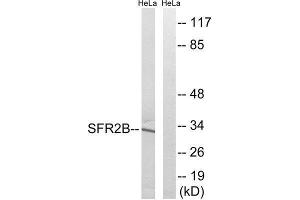 Western Blotting (WB) image for anti-serine/arginine-Rich Splicing Factor 8 (SRSF8) (Internal Region) antibody (ABIN1852230) (SFRS2B 抗体  (Internal Region))