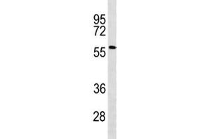 ACSF2 antibody western blot analysis in human Jurkat lysate. (ACSF2 抗体  (AA 587-615))