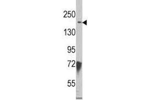 Western blot analysis of JMJD3 antibody and HeLa lysate