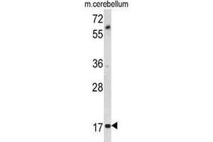 Western Blotting (WB) image for anti-Myelin Associated Oligodendrocyte Basic Protein (MOBP) antibody (ABIN3002875) (MOBP 抗体)