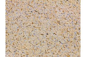 ABIN7096234 and ABIN7100296 at 1/100 staining rat brain tissue by IHC-P. (TRMT1L 抗体)