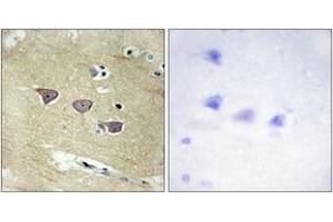 Immunohistochemistry analysis of paraffin-embedded human brain tissue, using CAMK5 Antibody. (CAMKV 抗体  (AA 211-260))