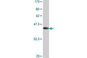 Western Blotting (WB) image for anti-SWI/SNF Related, Matrix Associated, Actin Dependent Regulator of Chromatin, Subfamily A, Member 5 (SMARCA5) (AA 59-147) antibody (ABIN563641)