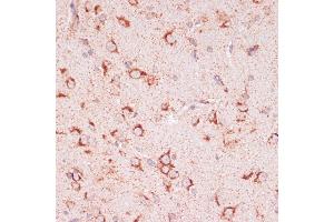 Immunohistochemistry of paraffin-embedded rat brain using ENTPD6 antibody (ABIN7266897) at dilution of 1:100 (40x lens). (ENTPD6 抗体  (AA 61-300))