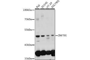 Western blot analysis of extracts of various cell lines, using ZNF701 antibody (ABIN7271523) at 1:1000 dilution. (ZNF701 抗体  (AA 100-200))