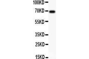 Anti-AFP Picoband antibody,  All lanes: Anti AFP  at 0. (alpha Fetoprotein 抗体  (AA 378-609))