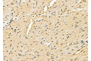 ABIN6261327 and ABIN6278854 at 1/100 staining Rat heart tissue by IHC-P. (DNAJA1 抗体  (C-Term))