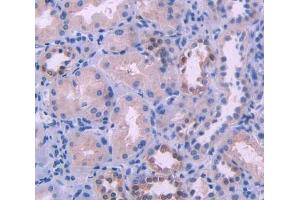 IHC-P analysis of kidney tissue, with DAB staining. (HFE2 抗体  (AA 234-416))