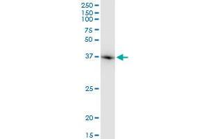 ACTB monoclonal antibody (M03), clone 1E7. (beta Actin 抗体  (AA 1-375))