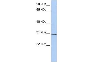 WB Suggested Anti-C14orf172 Antibody Titration:  0. (TRMT61A 抗体  (N-Term))