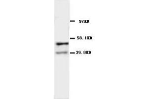 Image no. 2 for anti-Acetylcholine Receptor Subunit alpha (CHRNA1) (N-Term) antibody (ABIN1495052) (CHRNA1 抗体  (N-Term))