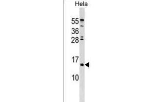 HHLA3 Antibody (Center) (ABIN1538602 and ABIN2849590) western blot analysis in Hela cell line lysates (35 μg/lane). (HHLA3 抗体  (AA 75-101))