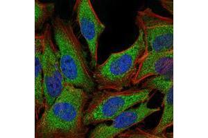 Immunofluorescence (IF) image for anti-Nuclear Receptor Subfamily 3, Group C, Member 1 (Glucocorticoid Receptor) (NR3C1) antibody (ABIN969321)