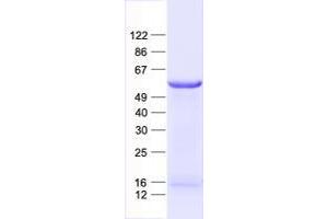 Western Blotting (WB) image for Zinc Finger Protein 79 (ZNF79) protein (His tag) (ABIN2736123)