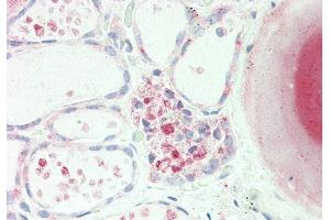 Immunohistochemistry (IHC) image for anti-Phosphodiesterase 1A (PDE1A) (C-Term) antibody (ABIN2785487)