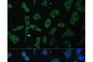 Immunofluorescence analysis of L-929 cells using EIF3D Polyclonal Antibody at dilution of 1:100. (EIF3D 抗体)