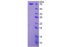 SDS-PAGE analysis of Human HSPA1L Protein. (HSPA1L 蛋白)