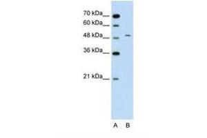 Image no. 2 for anti-Alanine Aminotransferase (ALT) (AA 81-130) antibody (ABIN320979) (ALT 抗体  (AA 81-130))
