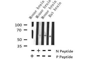 Western blot analysis of Phospho-Tyrosine Hydroxylase (Ser19) expression in various lysates (Tyrosine Hydroxylase 抗体  (pSer19))