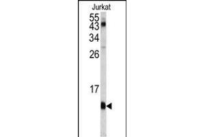 Western blot analysis of FKBP1A antibody (C-term) (ABIN1882082 and ABIN2841885) in Jurkat cell line lysates (35 μg/lane). (FKBP1A 抗体  (C-Term))