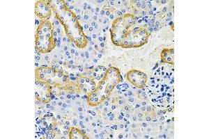 Immunohistochemistry of paraffin-embedded mouse kidney using KRT20 Antibody.
