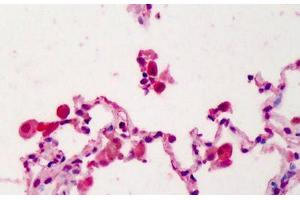Human Lung: Formalin-Fixed, Paraffin-Embedded (FFPE) (IL22 Receptor alpha 1 抗体  (N-Term))