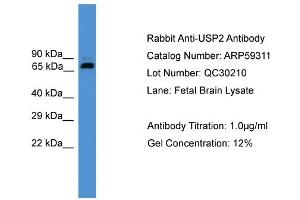 WB Suggested Anti-USP2  Antibody Titration: 0. (USP2 抗体  (Middle Region))