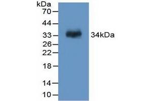 Detection of Recombinant F13A1, Rat using Polyclonal Antibody to Coagulation Factor XIII A1 Polypeptide (F13A1) (F13A1 抗体  (AA 140-377))