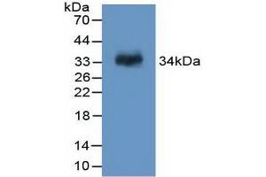 Detection of Recombinant F13A1, Rat using Polyclonal Antibody to Coagulation Factor XIII A1 Polypeptide (F13A1)