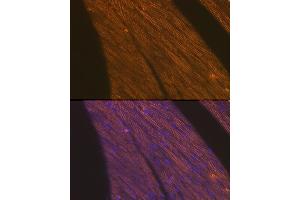 Immunofluorescence analysis of rat heart cells using Cardiac troponin T (TNNT2) Rabbit pAb (ABIN3021485, ABIN3021486, ABIN3021487 and ABIN6215132) at dilution of 1:100 (40x lens).