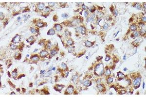 Immunohistochemistry (Paraffin-embedded Sections) (IHC (p)) image for anti-Deoxyuridine Triphosphatase (DUT) antibody (ABIN7260715)