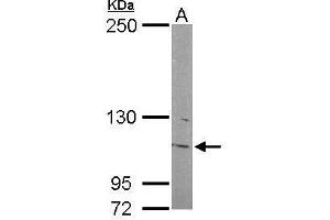 Western Blotting (WB) image for anti-Inositol Polyphosphate-5-Phosphatase F (INPP5F) antibody (ABIN2855799)