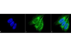 Immunocytochemistry/Immunofluorescence analysis using Rabbit Anti-KDEL Polyclonal Antibody (ABIN863187 and ABIN863188). (KDEL 抗体)