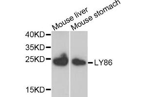 Western blot analysis of extracts of mouse liver and mouse stomach, using LY86 antibody. (LY86 抗体)