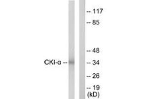 Western blot analysis of extracts from HeLa cells, using CKI-alpha Antibody. (CSNK1A1 抗体  (AA 126-175))