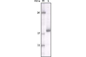 Western Blotting (WB) image for anti-Discoidin Domain Receptor tyrosine Kinase 2 (DDR2) (truncated) antibody (ABIN2464044) (DDR2 抗体  (truncated))