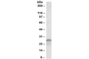 Western blot testing of human cerebellum lysate with Calbindin 1 antibody at 0. (CALB1 抗体)