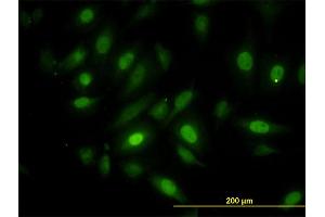 Immunofluorescence of monoclonal antibody to NEK10 on HeLa cell. (NEK10 抗体  (AA 211-300))