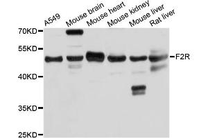Western blot analysis of extracts of various cell lines, using F2R antibody (ABIN5974987) at 1/1000 dilution. (PAR1 抗体)