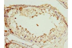 Immunohistochemistry of paraffin-embedded human testis tissue using ABIN7168517 at dilution of 1:100 (SCAPER 抗体  (AA 1109-1400))