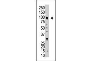 The USP5 polyclonal antibody  is used in Western blot to detect USP5 in HL-60 cell lysate . (USP5 抗体  (AA 59-90))